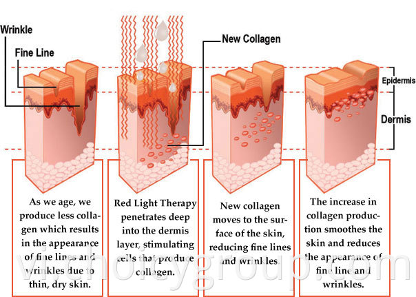 Hiệu ứng của Red-Light1.jpg